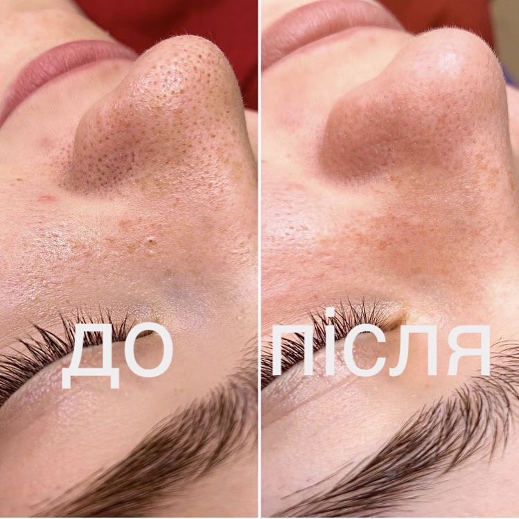 «Ольга Лисенко» Ціни, Відгуки - косметолог-ін'єкціоніст в Києві ...