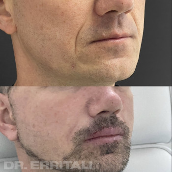 Абдель Эрритали, Харків Фото - 97