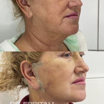 Абдель Эрритали, Харків Фото - 99