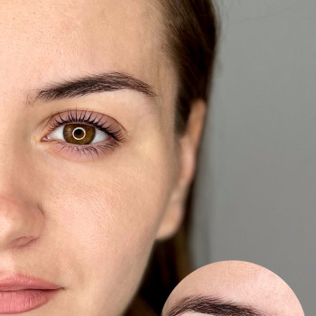 Тамара Івонча, Чернівці Фото - 7