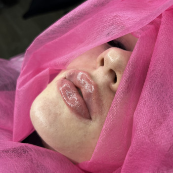 Atmosfera Krasu cosmetology, Чернівці Фото - 42