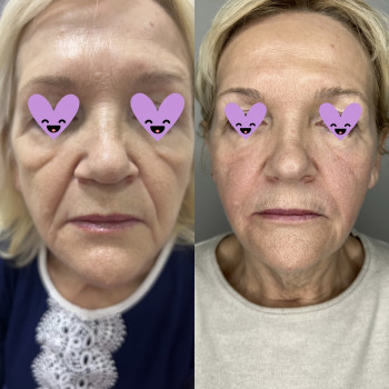 Atmosfera Krasu cosmetology, Чернівці Фото - 44