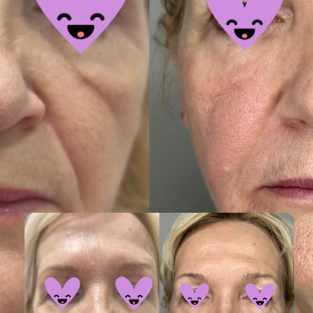 Atmosfera Krasu cosmetology, Чернівці Фото - 45