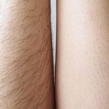 Atmosfera Krasu cosmetology, Чернівці Фото - 47