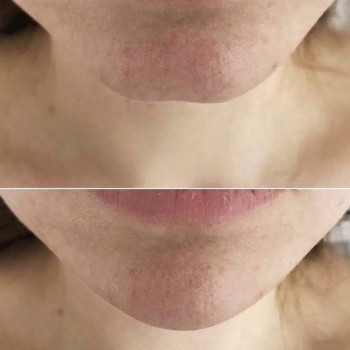 Atmosfera Krasu cosmetology, Чернівці Фото - 51