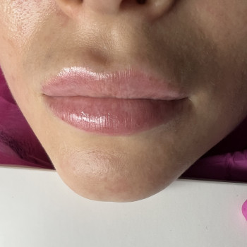 Atmosfera Krasu cosmetology, Чернівці Фото - 57