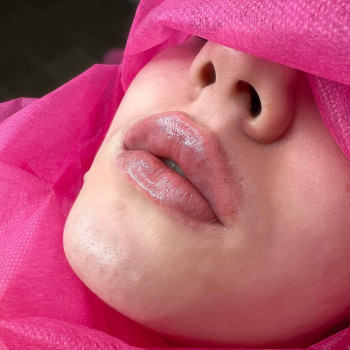 Atmosfera Krasu cosmetology, Чернівці Фото - 76