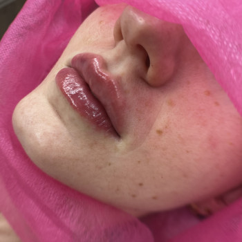 Atmosfera Krasu cosmetology, Чернівці Фото - 86