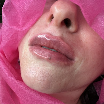 Atmosfera Krasu cosmetology, Чернівці Фото - 89