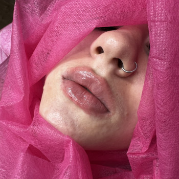 Atmosfera Krasu cosmetology, Чернівці Фото - 96