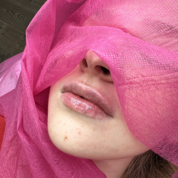 Atmosfera Krasu cosmetology, Чернівці Фото - 97