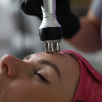 RF лифтинг лица