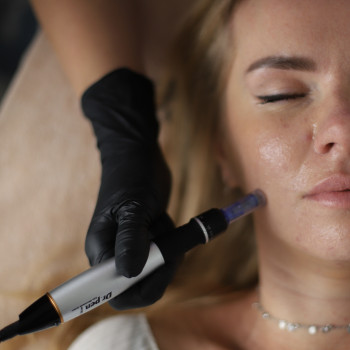 Фракционная мезотерапия