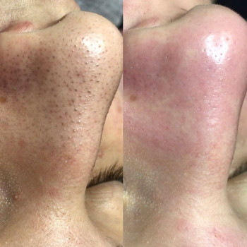 Майя Сальникова, Житомир Фото - 6