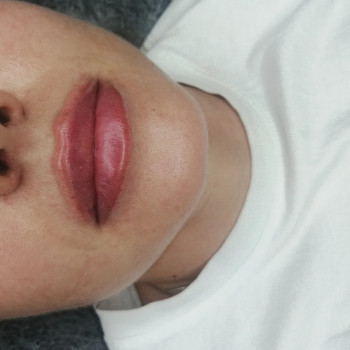 Фото из портфолио косметолога Руслана Богунова (Одесса)