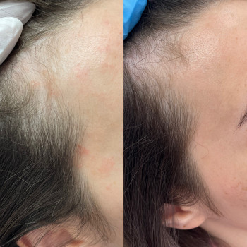 Катерина Труш, Київ Фото - 11