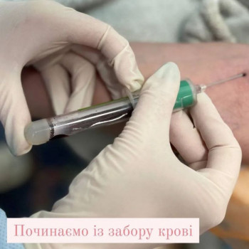 Плазмоліфтинг обличчя
                    Косметолог Людмила Киев