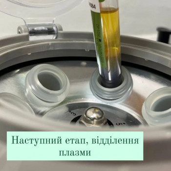 Плазмоліфтинг обличчя
                    Косметолог Людмила Киев