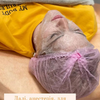 Плазмоліфтинг обличчя
                    Косметолог Людмила Киев