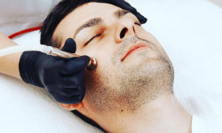 Микротоки для лица - Мужские уходовые процедуры Косметолог-инъекционист Вероника Одесса