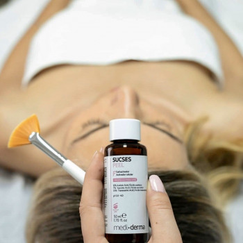 Професійні пілінги