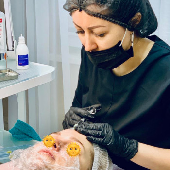 Мезотерапія