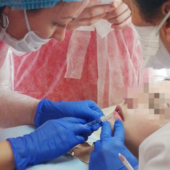 Контурна пластика