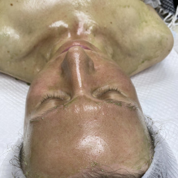 Ферментотерапія