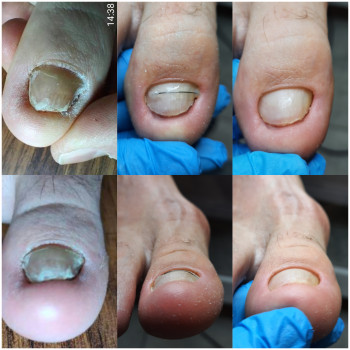 Олена Коваль, Киев Фото - 59