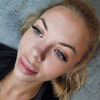 збільшення губ, нарощеннявій