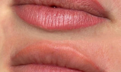 Видалення перманентний макіяжу і татуажу Майстер перманентного макіяжу Вікторія Луцьк