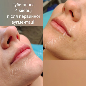 Наталия Мартыненко, Сумы Фото - 64