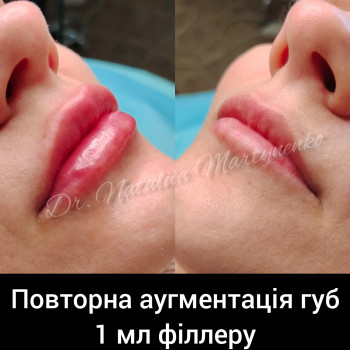 Наталия Мартыненко, Сумы Фото - 66