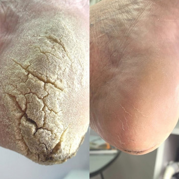 Руслана Петровна Гончарова, Одесса Фото - 63