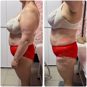 Енжой, Запоріжжя Фото - 59