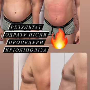 Енжой, Запоріжжя Фото - 60