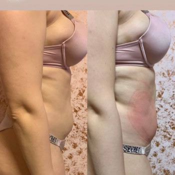 Енжой, Запоріжжя Фото - 62