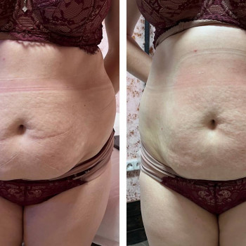 Енжой, Запоріжжя Фото - 63