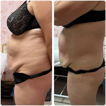 Енжой, Запоріжжя Фото - 64