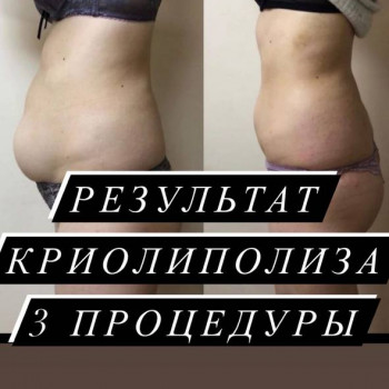 Енжой, Запоріжжя Фото - 65