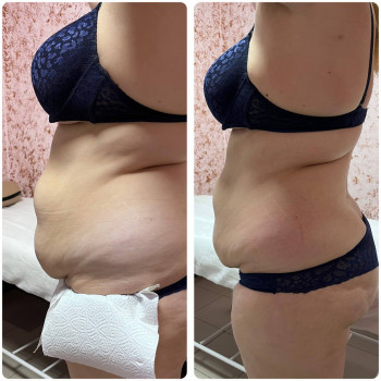 Енжой, Запоріжжя Фото - 66