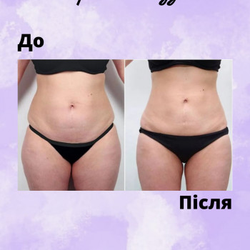 Енжой, Запоріжжя Фото - 68