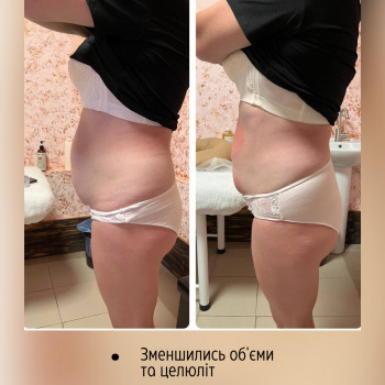 Енжой, Запоріжжя Фото - 69