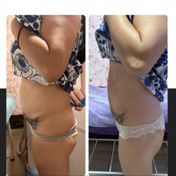 Енжой, Запоріжжя Фото - 70