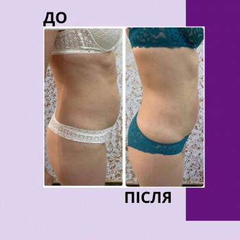 Енжой, Запоріжжя Фото - 71