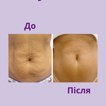 Енжой, Запоріжжя Фото - 72