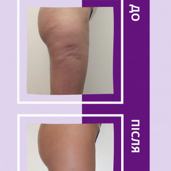 Енжой, Запоріжжя Фото - 73