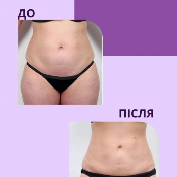 Енжой, Запоріжжя Фото - 74