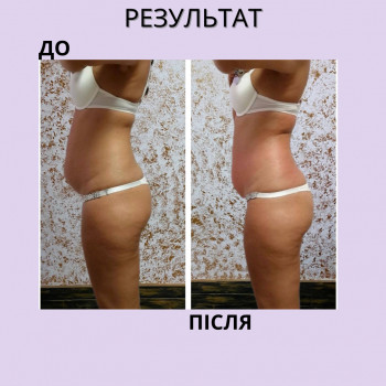 Енжой, Запоріжжя Фото - 75