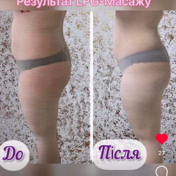 Енжой, Запоріжжя Фото - 76